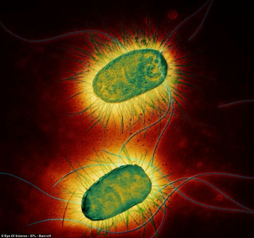 Beberapa bakteri dan virus paling mematikan di dunia 